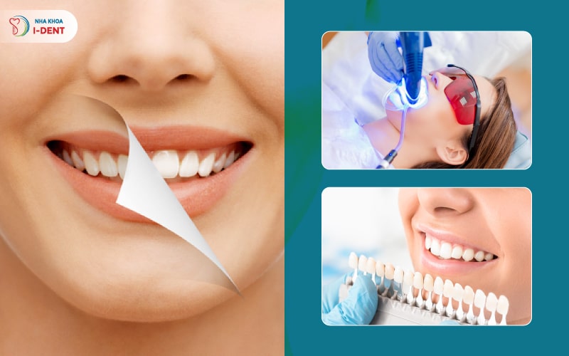 Bọc răng sứ giúp mang lại hiệu quả thẩm mỹ cao