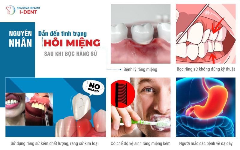 Nguyên nhân dẫn đến tình trạng hôi miệng sau khi bọc răng sứ