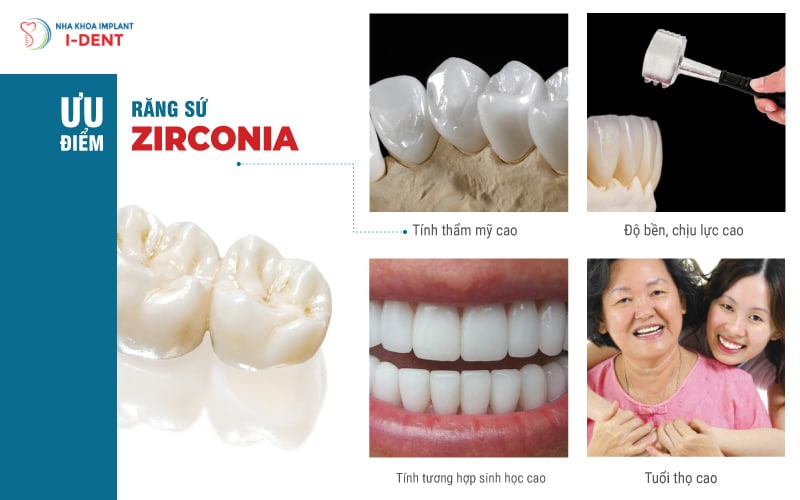Ưu-điểm-vượt-trội-của-răng-sứ-Zirconia