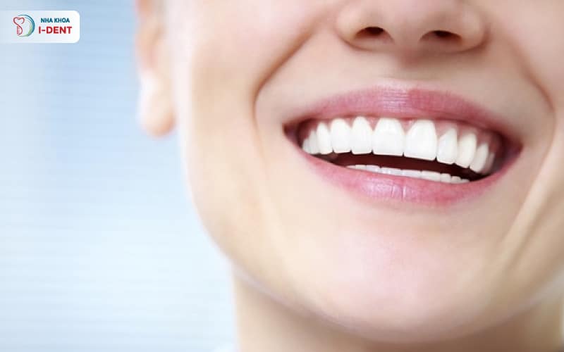 Răng sứ Vita có tính thẩm mỹ cao