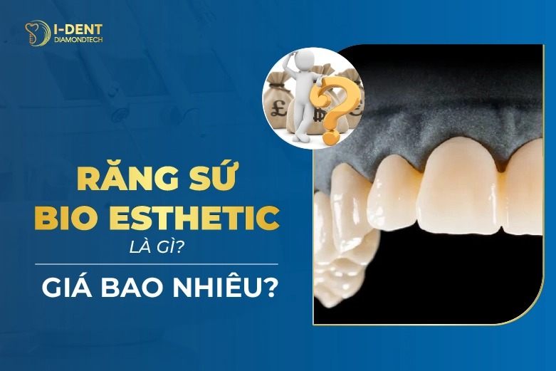 Phủ Sứ Bio Veneer Là Gì? Tìm Hiểu Về Công Nghệ Thẩm Mỹ Răng Hiện Đại