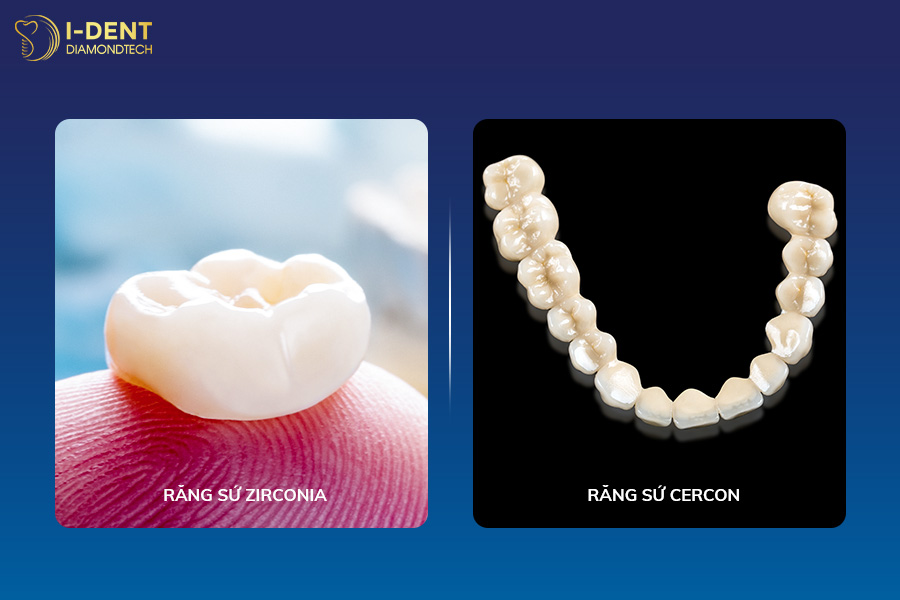 răng sứ zirconia và cercon