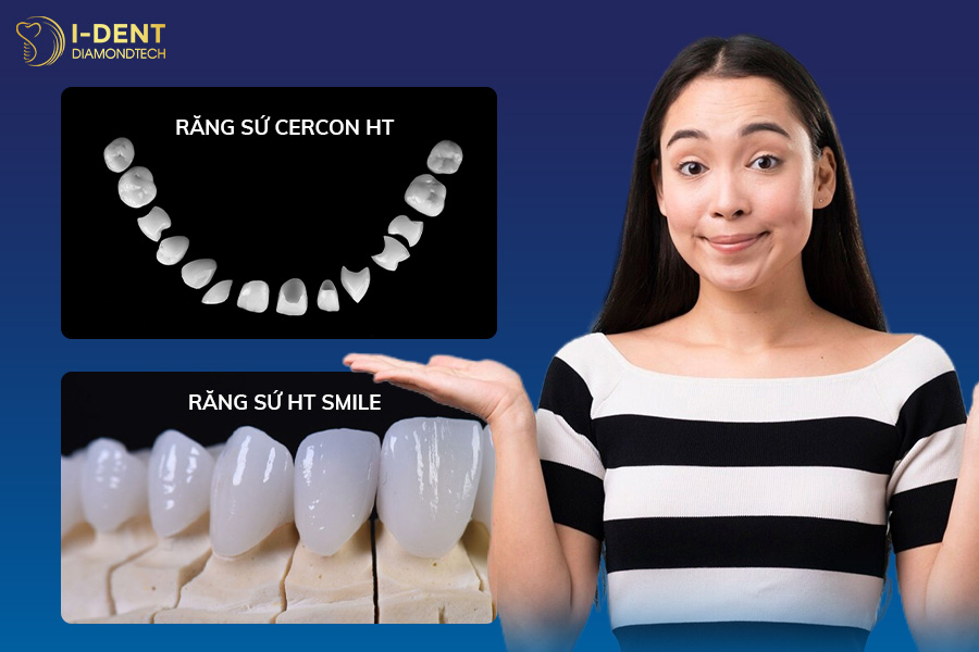 Nên lựa chọn răng sứ Cercon HT hay HT Smile