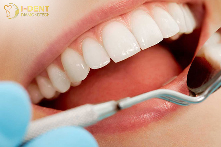 có nên làm răng sứ thẩm mỹ không