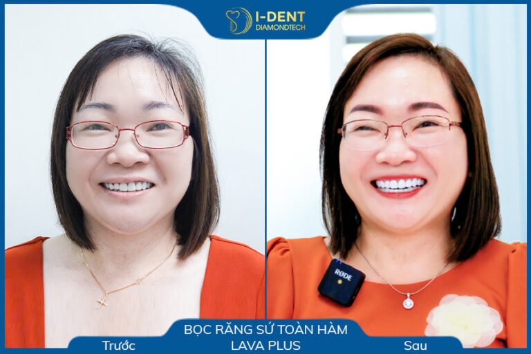 câu chuyện khách hàng hoàng thị xen