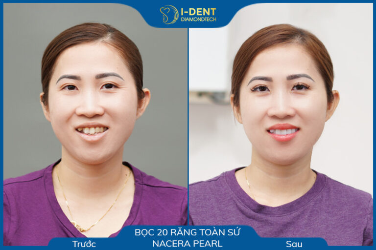 câu chuyện khách hàng làm răng sứ nguyễn ngọc thúy oanh