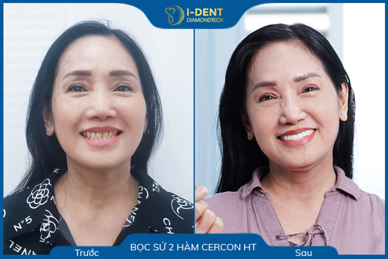 câu chuyện khách hàng cô phạm thị bích sơn