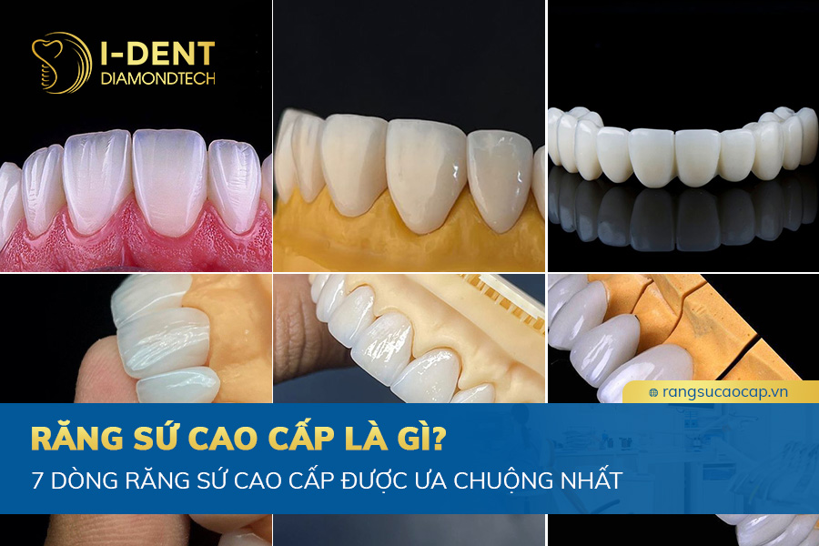 răng sứ cao cấp