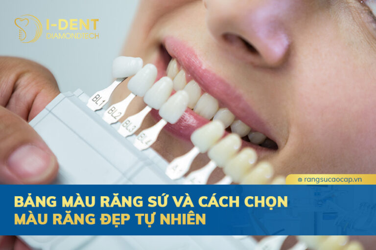 bảng màu răng sứ