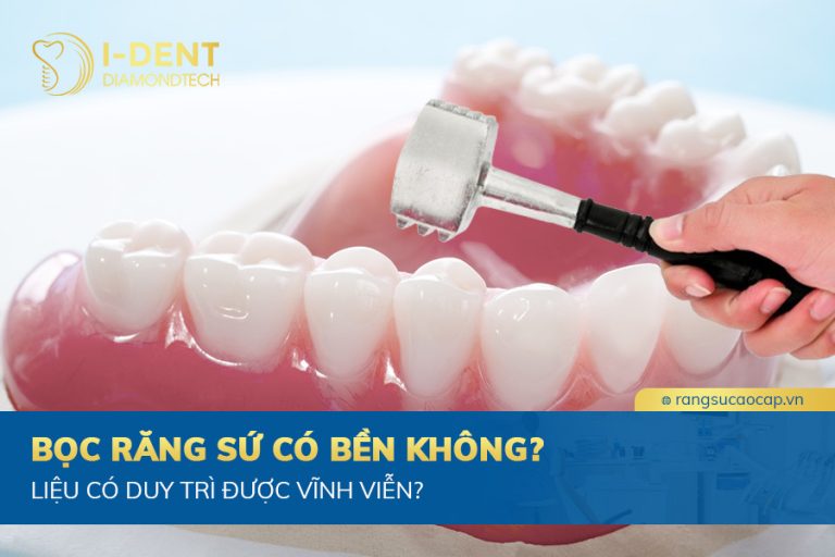 bọc răng sứ có bền không