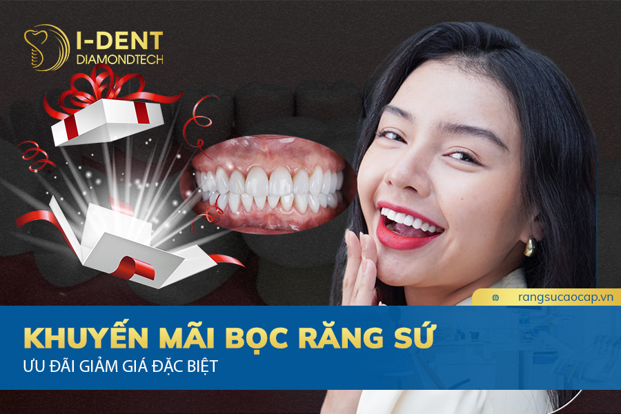 khuyến mãi bọc răng sứ