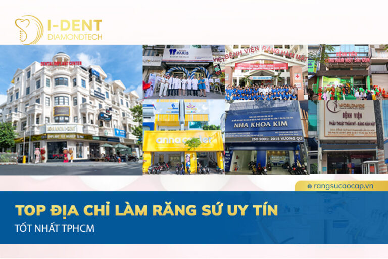bọc răng sứ ở đâu tốt nhất