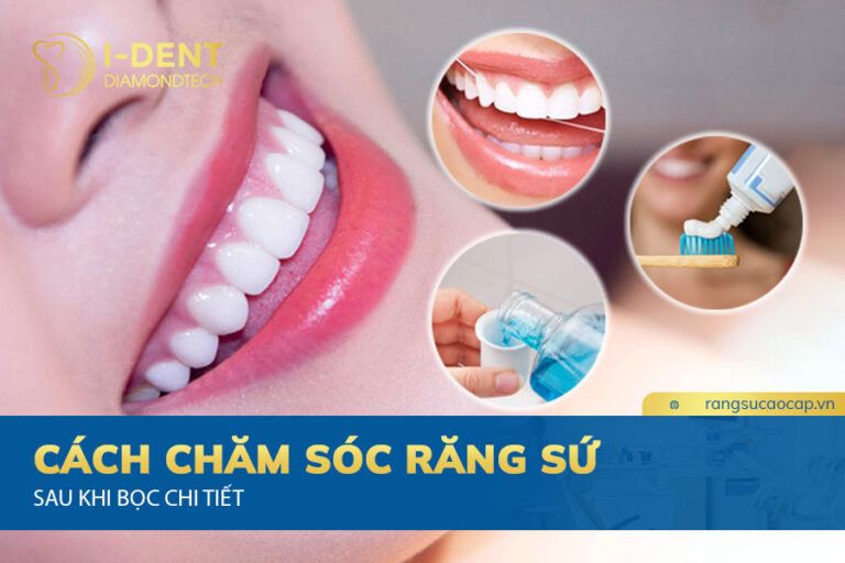 cách chăm sóc răng sứ