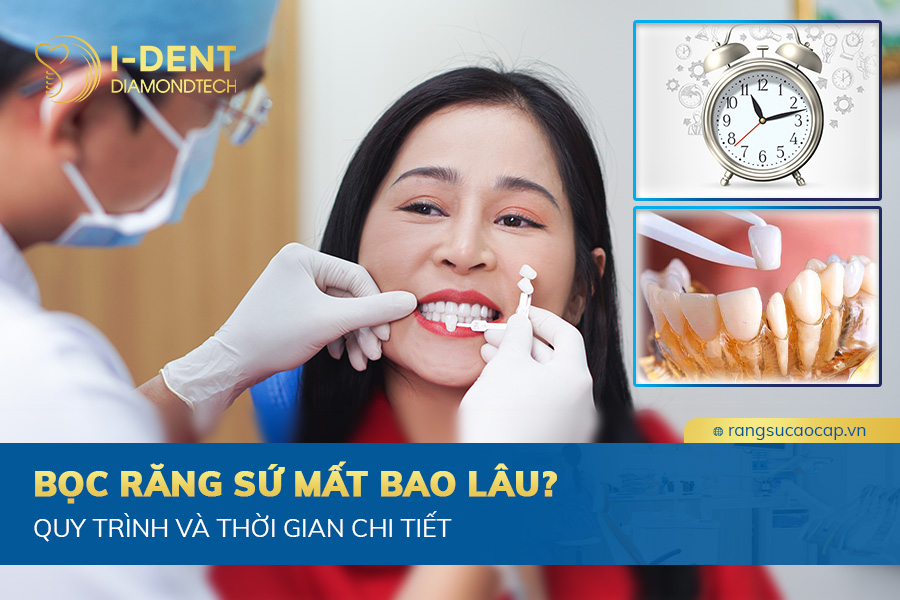 làm răng sứ mất bao lâu