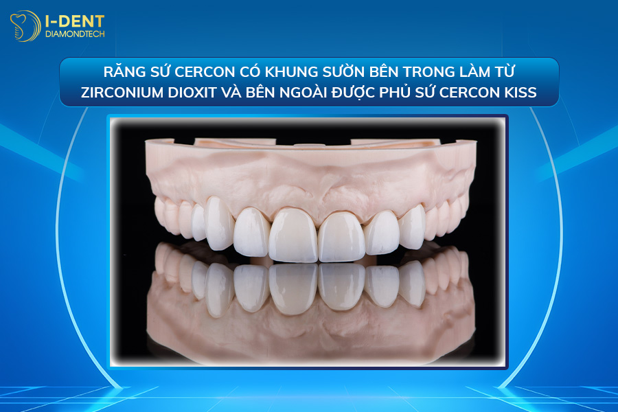 so sánh răng zirconia và răng cercon