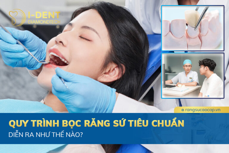 quy trình bọc răng sứ