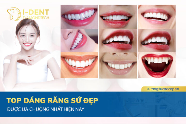 răng sứ đẹp