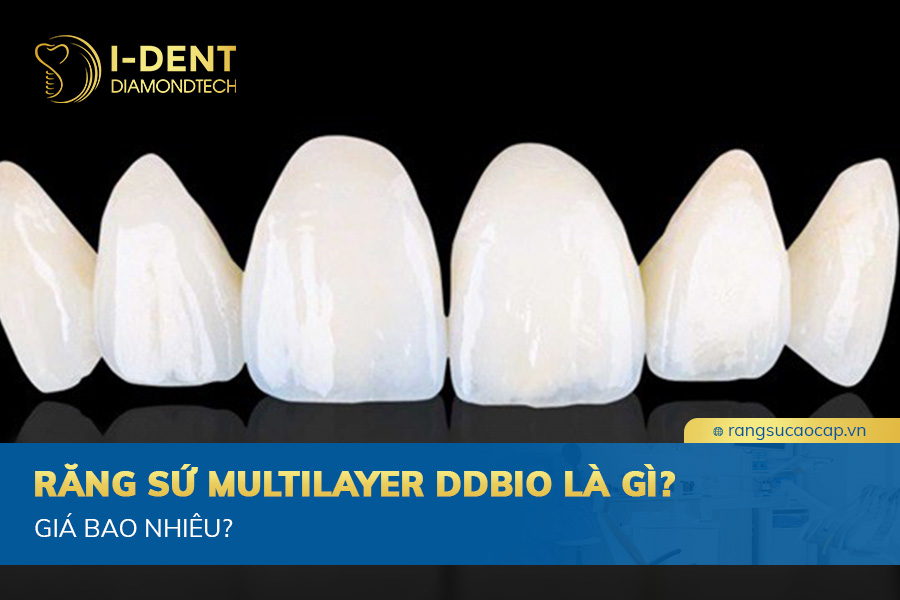 răng sứ multilayer ddbio