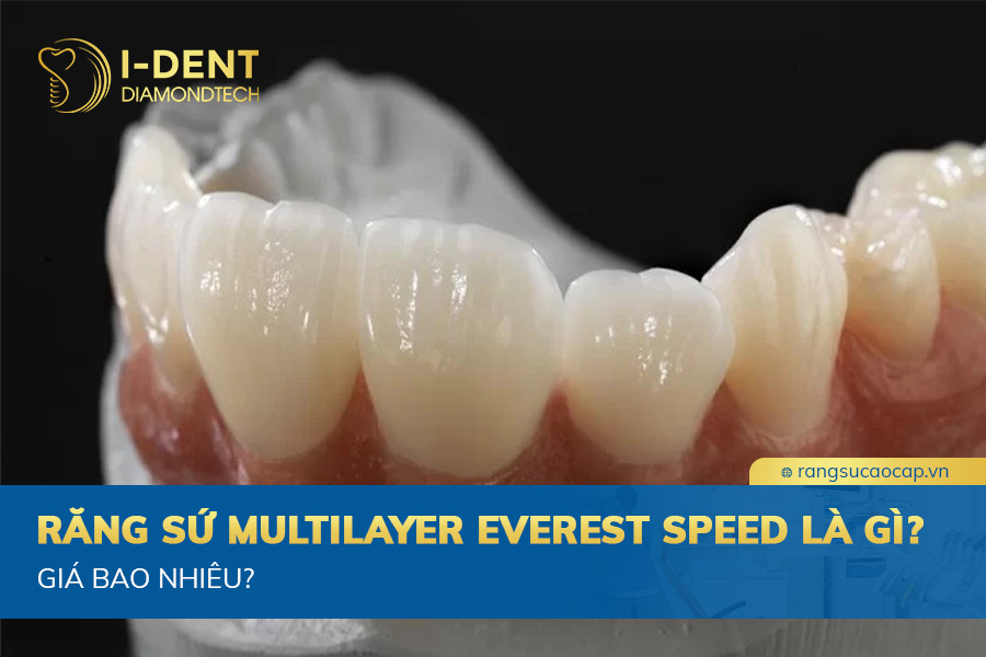răng sứ multilayer everest speed