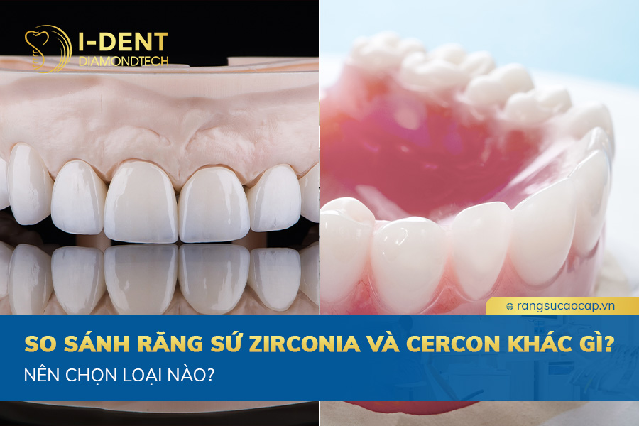 so sánh răng sứ zirconia và cercon