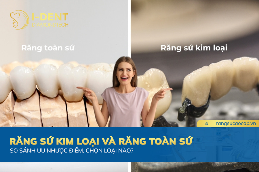 sứ kim loại và toàn sứ