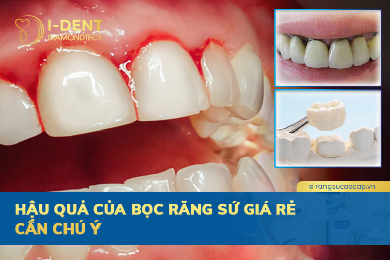 hậu quả bọc răng sứ