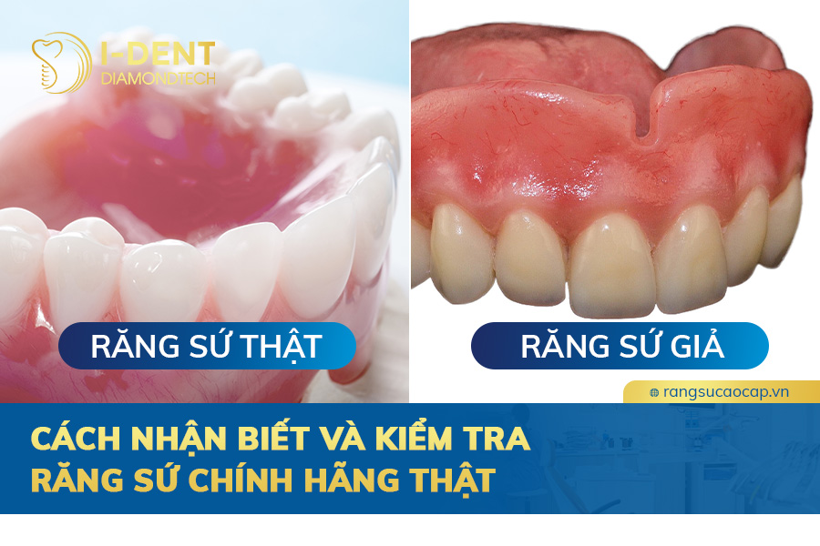 cách kiểm tra răng sứ chính hãng