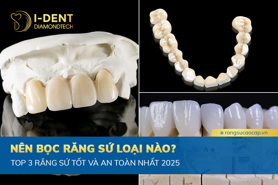 nên bọc răng sứ loại nào