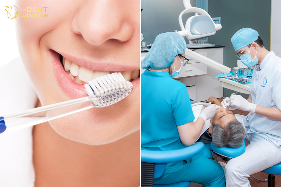 răng sứ bị xỉn màu