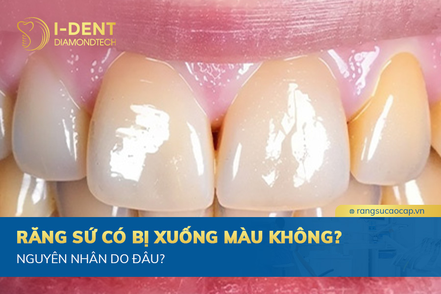 răng sứ có bị xuống màu không