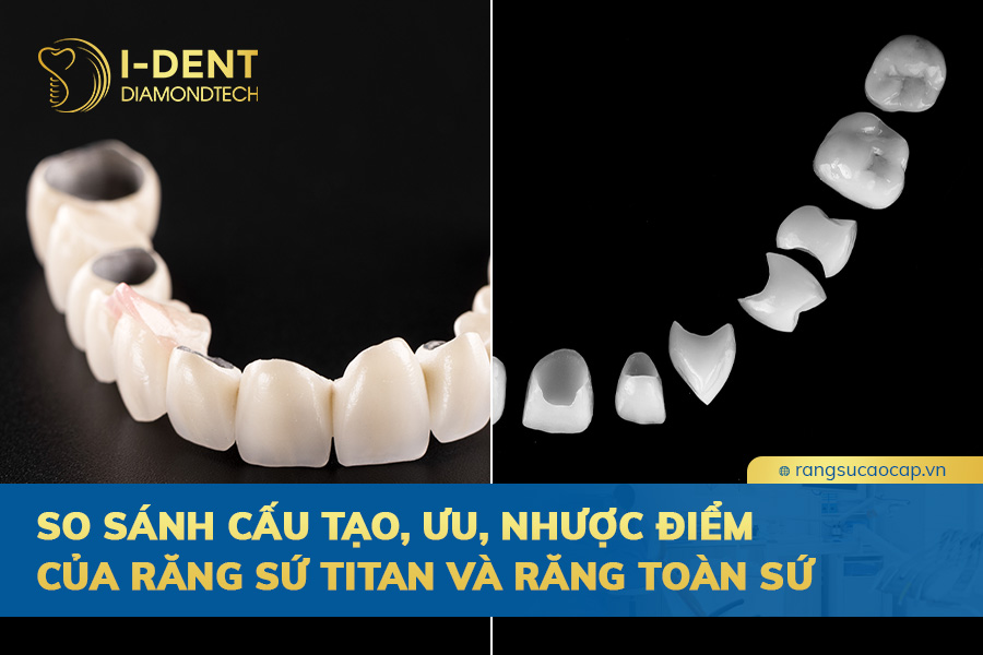 so sánh răng sứ titan và răng toàn sứ