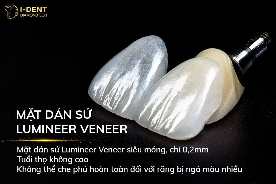 có mấy loại dán sứ veneer