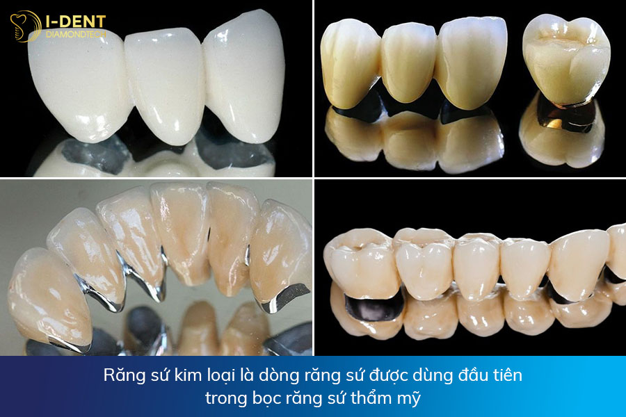 làm răng sứ giá 1 triệ