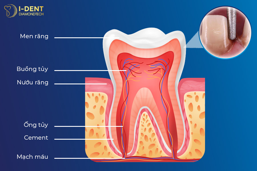 mài răng ảnh hưởng đến thần kinh