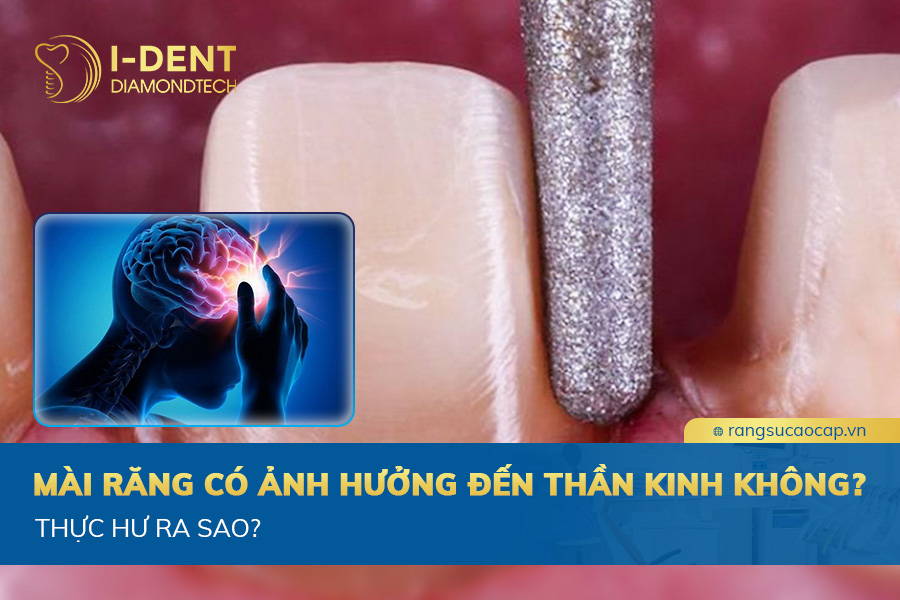 mài răng có ảnh hưởng đến thần kinh không