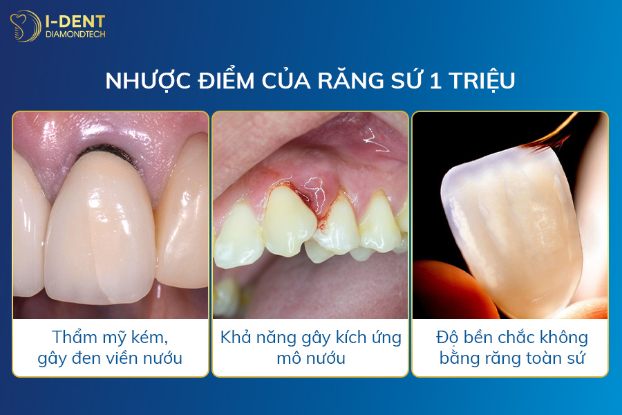 răng bọc sứ giá 1 triệu