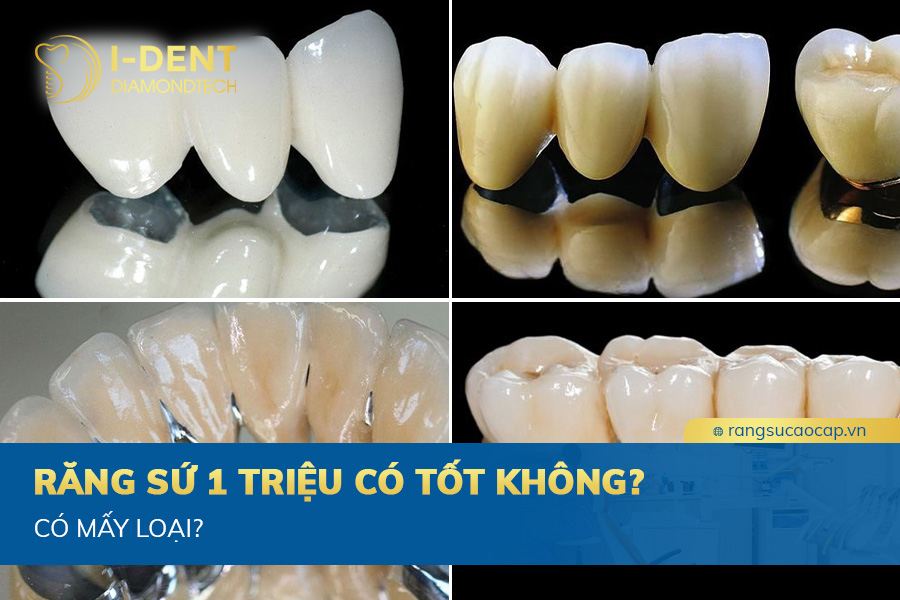 răng sứ 1 triệu có tốt không