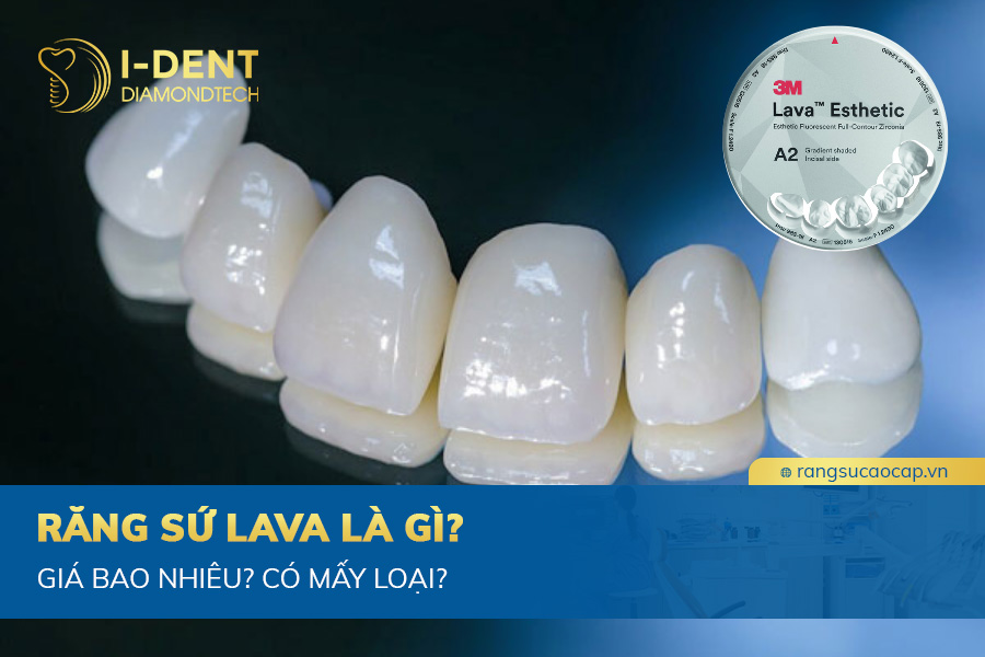 răng sứ lava