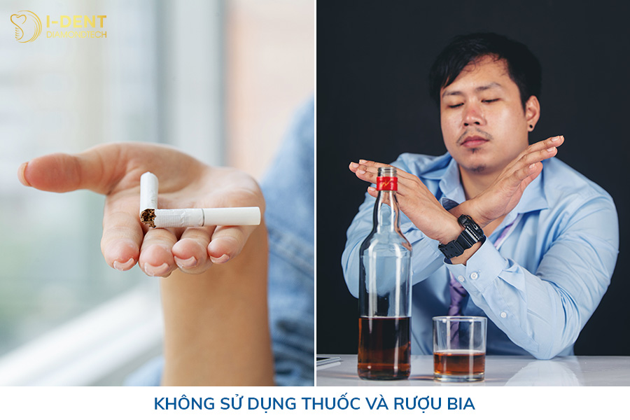 sau khi mài răng bọc sứ nên kiêng gì