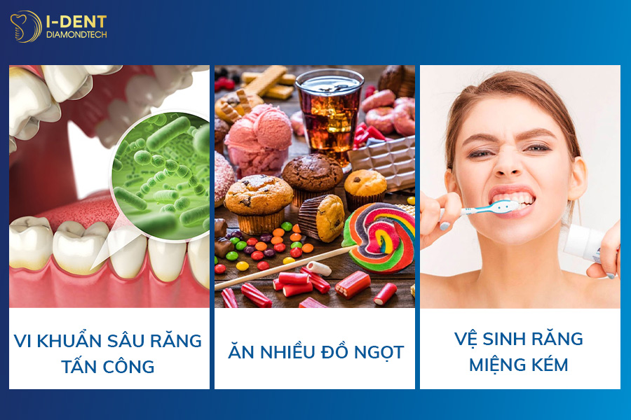 bọc răng sứ cho răng cửa bị sâu