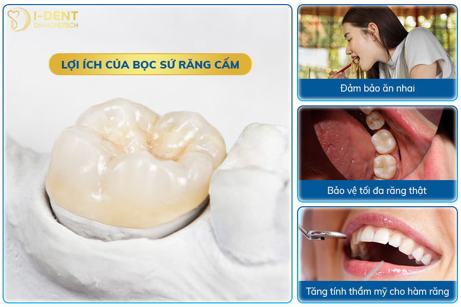 bọc sứ răng cấm