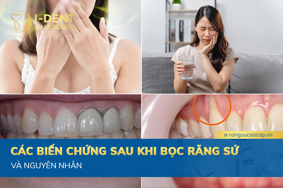 biến chứng sau khi bọc răng sứ
