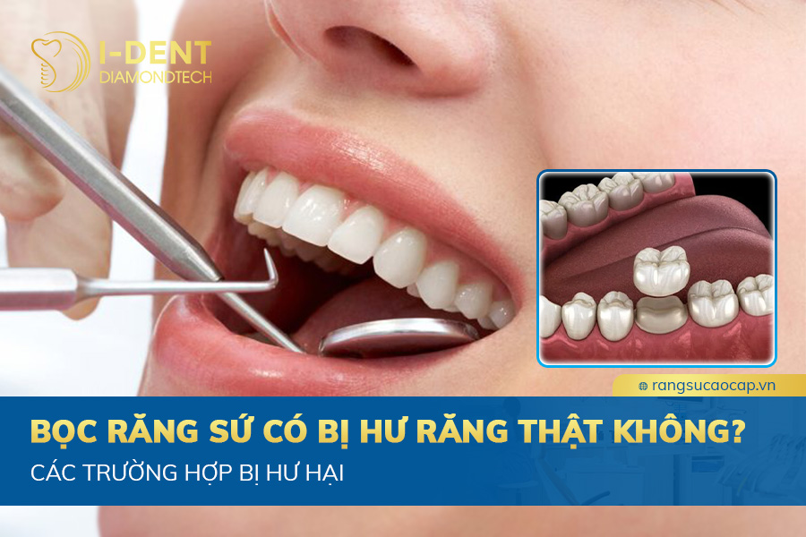 bọc răng sứ có bị hư răng thật không