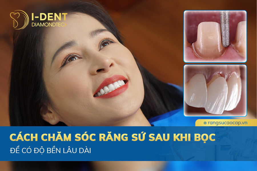 nước súc miệng cho răng sứ