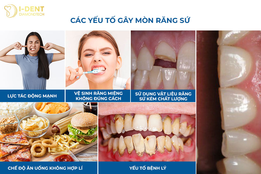răng sứ có mòn không