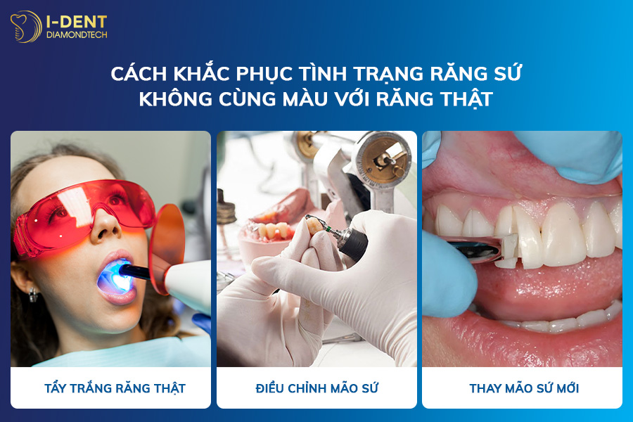 răng sứ khác màu răng thật