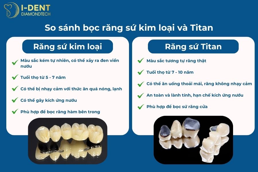răng sứ kim loại và răng sứ titan