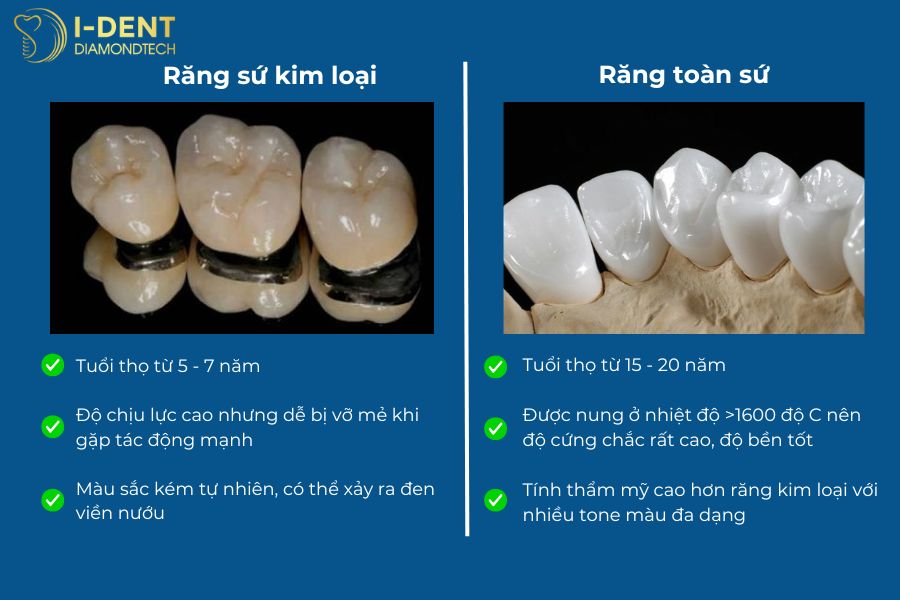 răng toàn sứ và răng sứ kim loại