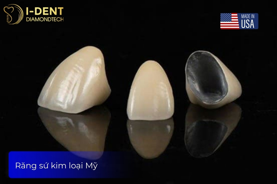 giá răng sứ mỹ