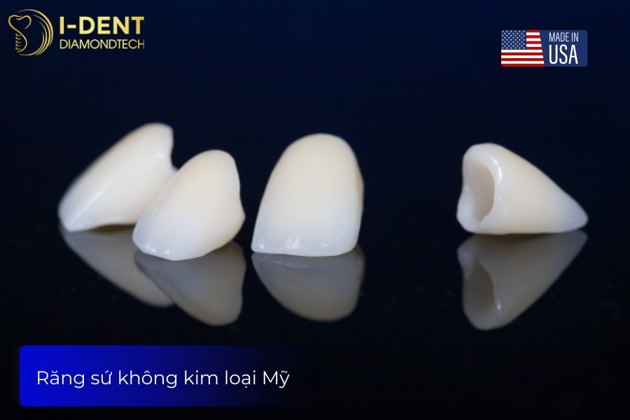 răng sứ mỹ có tốt không